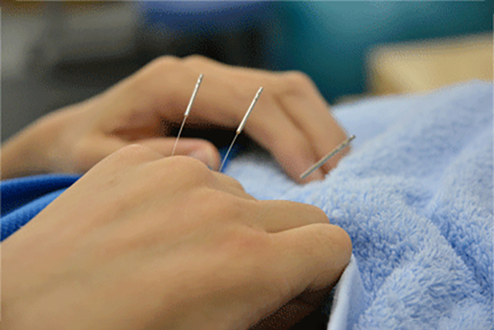 意外と知らない、鍼の効果